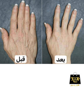 ماسک دست زوزو