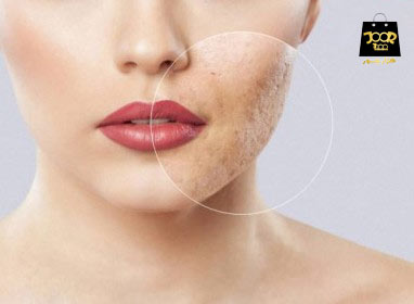 علائم دهیدراته بودن پوست